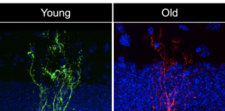 我们的大脑会比身体其他部位衰老得更快吗?